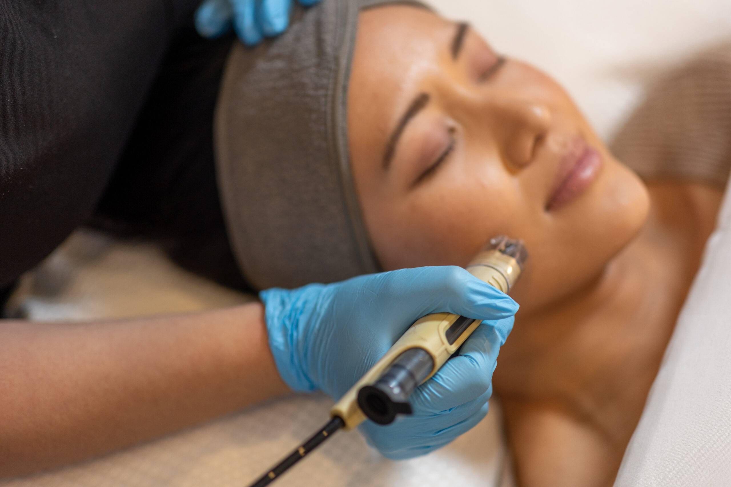 A woman is receiving a dermafrac treatment with a modern device handled by a skincare professional wearing blue gloves. The woman appears relaxed and has her eyes closed.