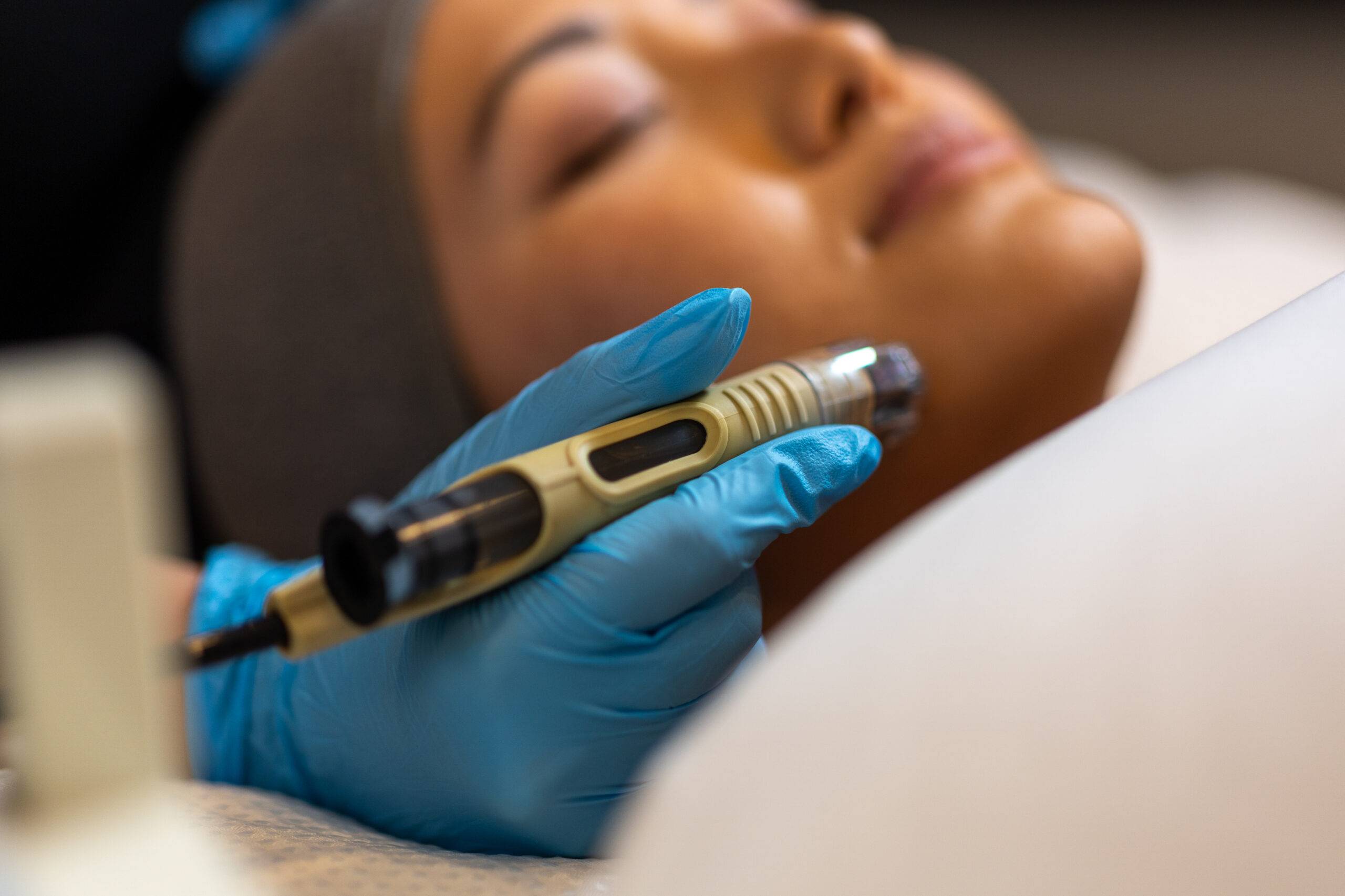 A woman reclines while receiving a microdermabrasion treatment; a professional holds a skin therapy device near her cheek, wearing blue gloves, indicating a sterile environment.