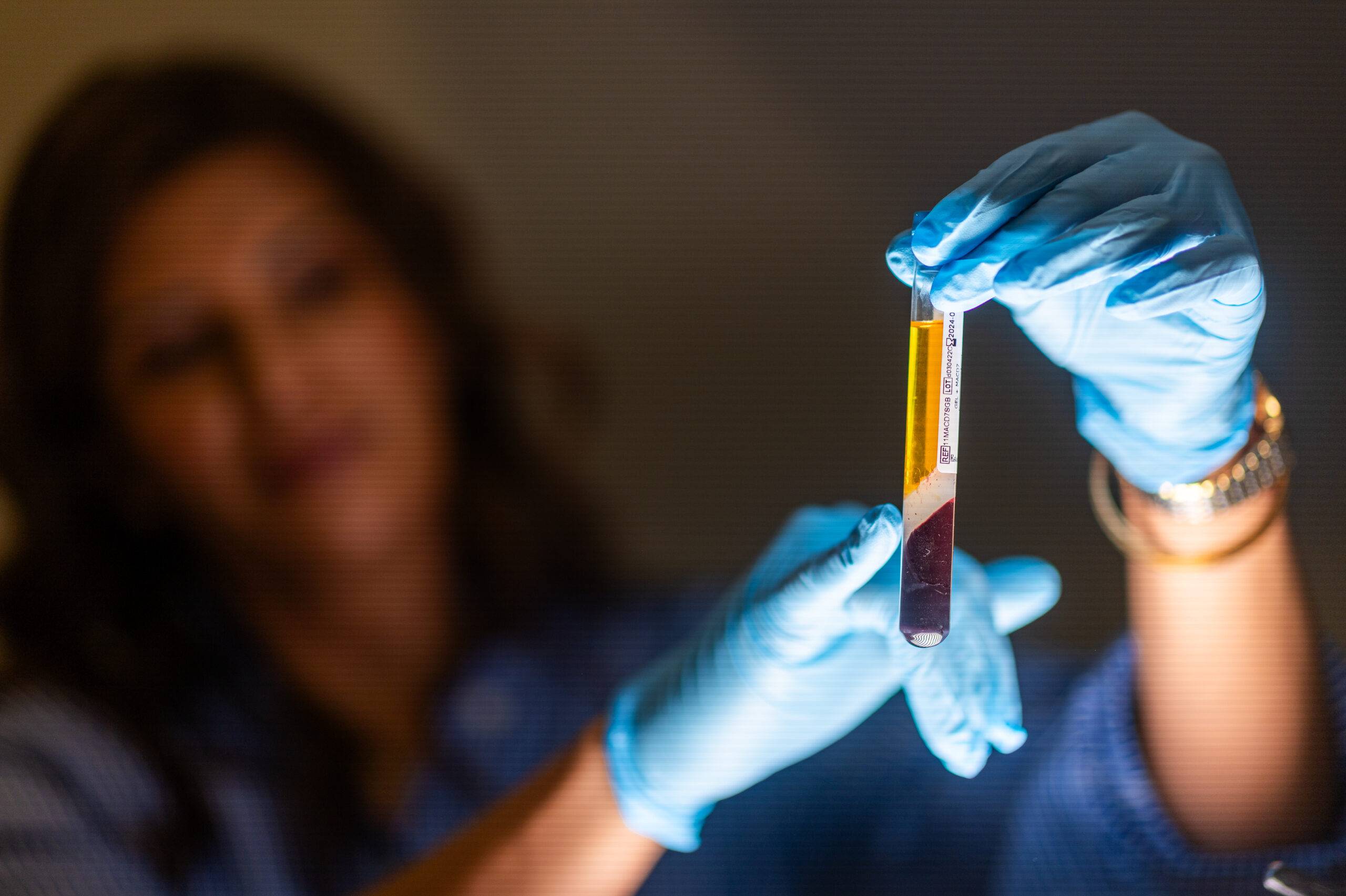 A female scientist in a lab coat examines a test tube containing a yellow substance, possibly skinboosters, with her focus concentrated on the tube, while slightly blurred in the background.