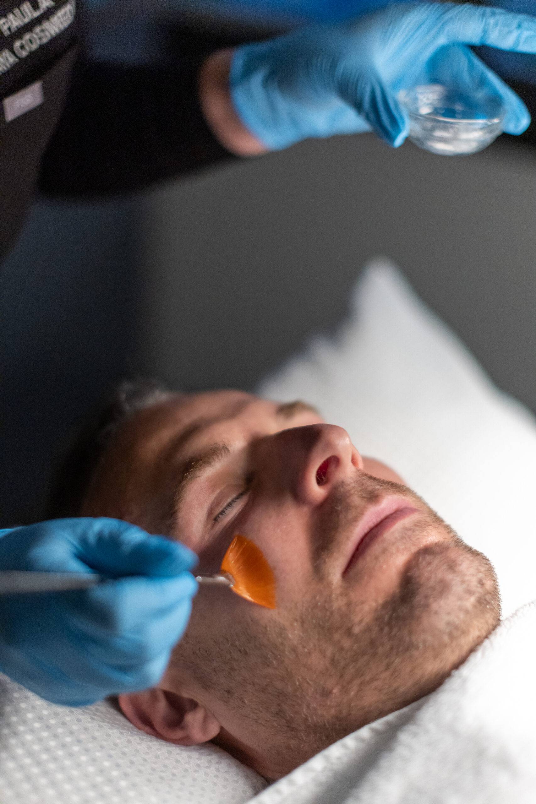 A man lying on a treatment bed receiving an acne treatment with a gel mask, while a professional in blue gloves carefully applies a solution to his face.