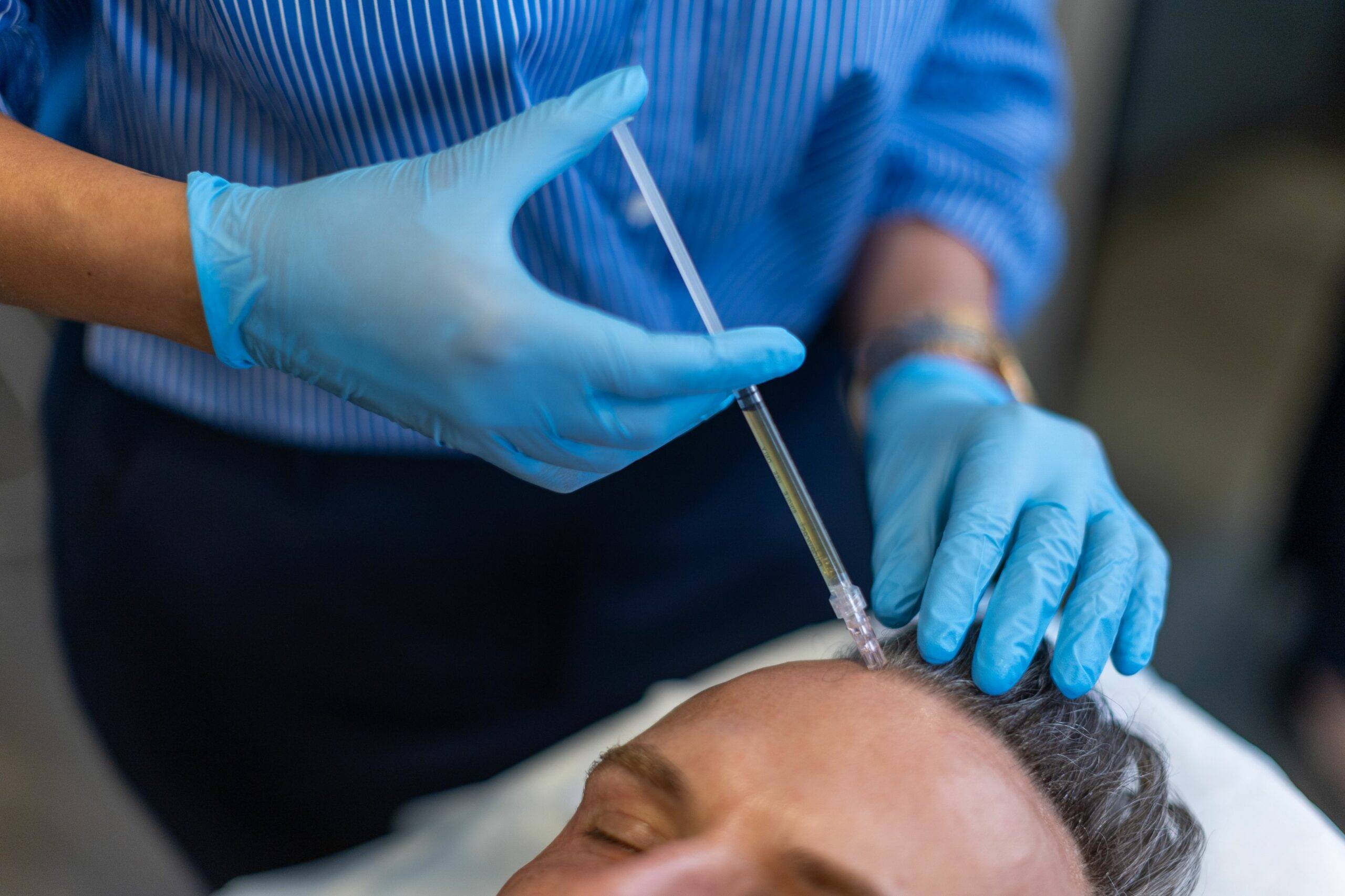 A healthcare professional in blue gloves administers a hair restoration injection to a patient's forehead, using a syringe. The patient is lying down and has their eyes closed.