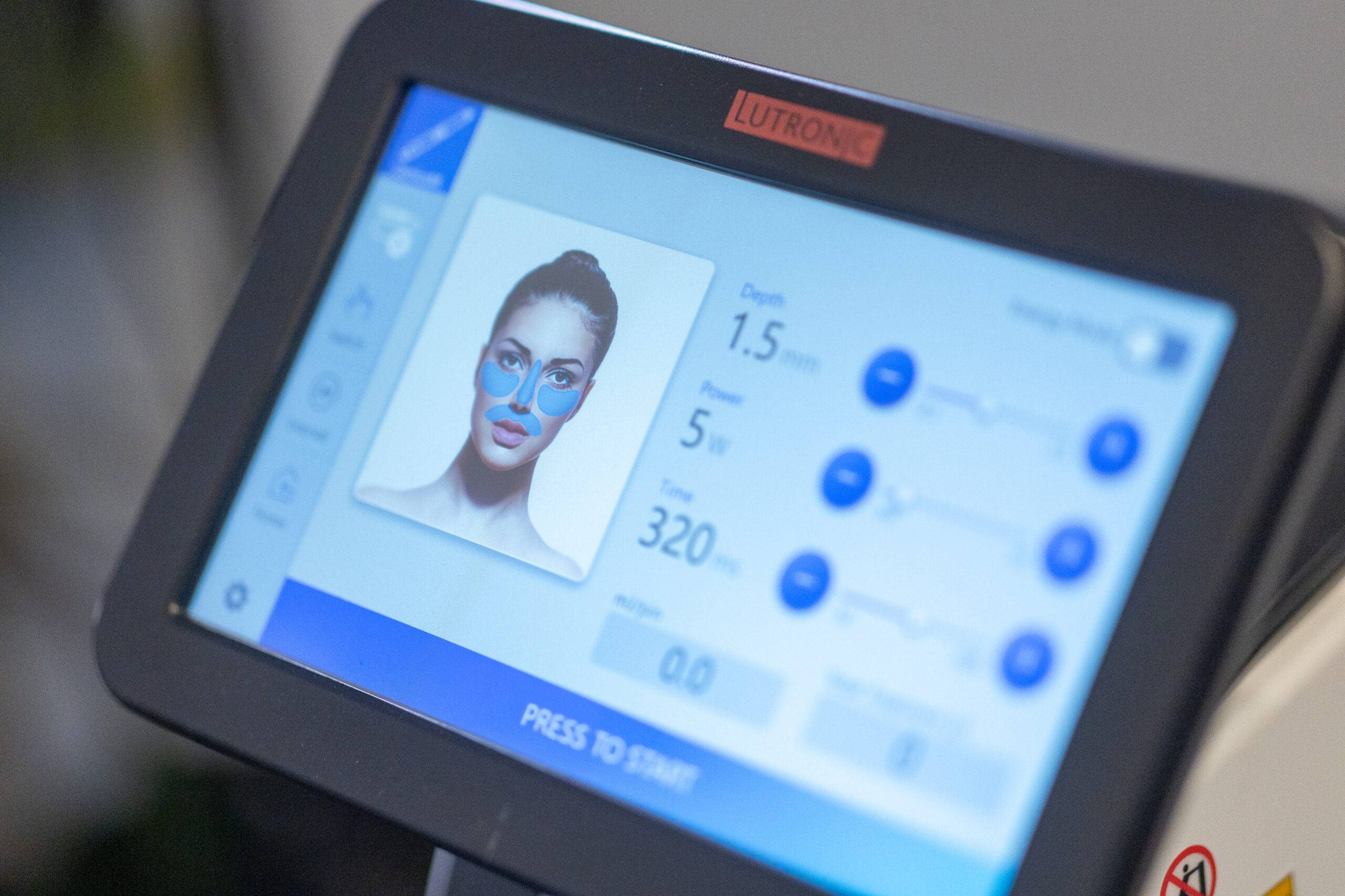 A close-up view of a Genius Radiofrequency Microneedling device screen displaying settings and a graphical representation of a woman's face for treatment purposes.