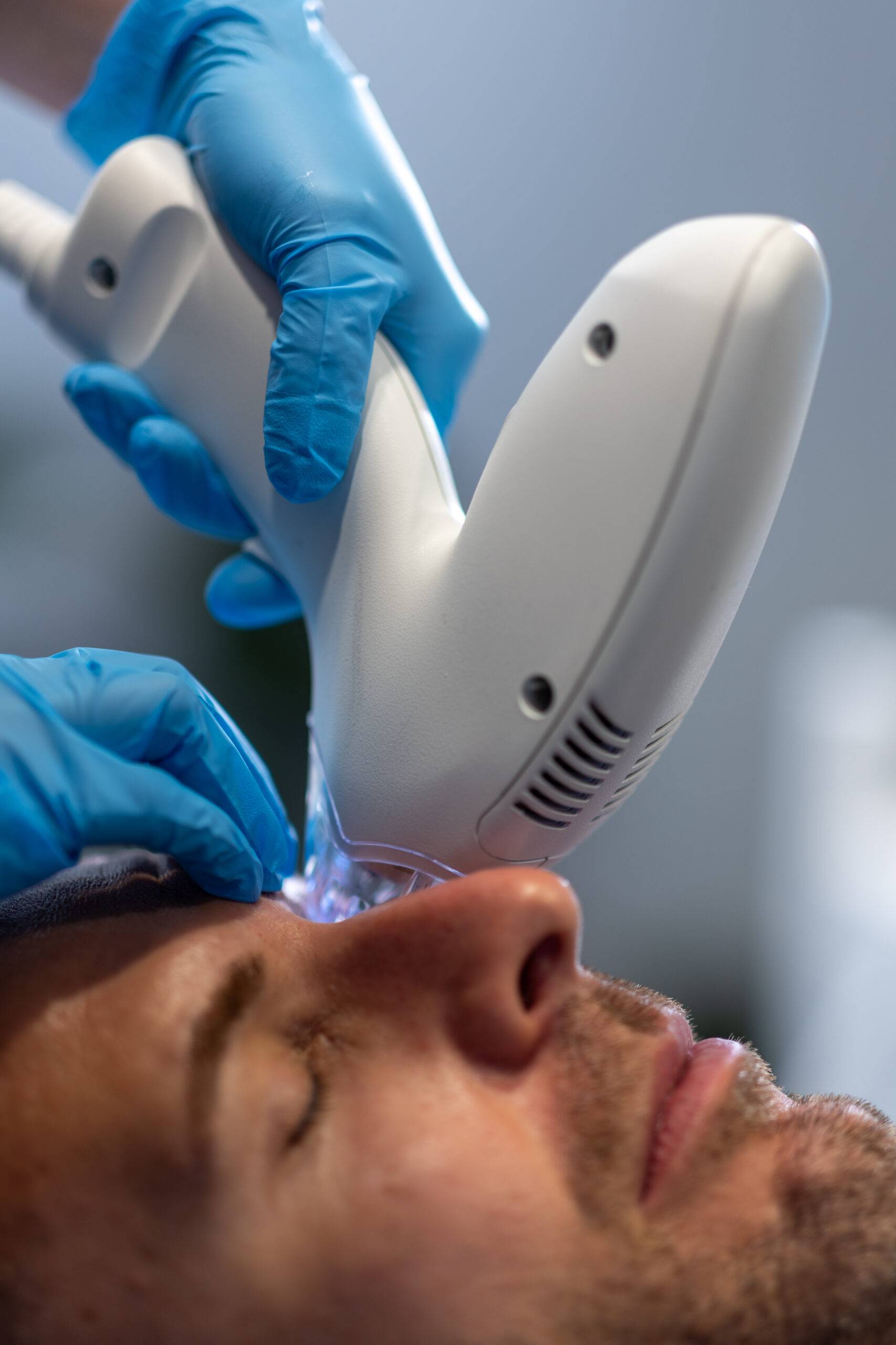 A close-up view of a man undergoing a facial treatment with a Tixel device, administered by a professional wearing blue gloves. The focus is on the device touching the man's face.