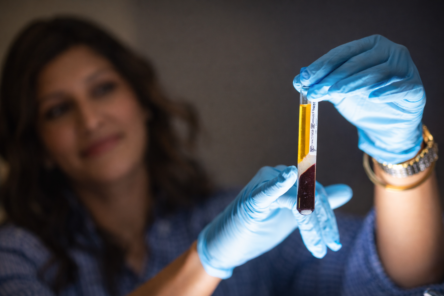 A person wearing blue gloves holds up a test tube containing a yellow and dark red liquid, focusing on the sample related to regenerative aesthetics, while the background is blurred.